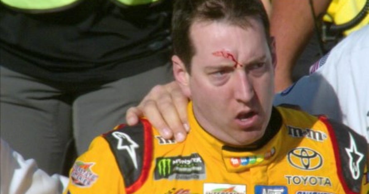 Kyle Busch leaves Las Vegas bloodied after brawl with Joey Logano | FOX ...