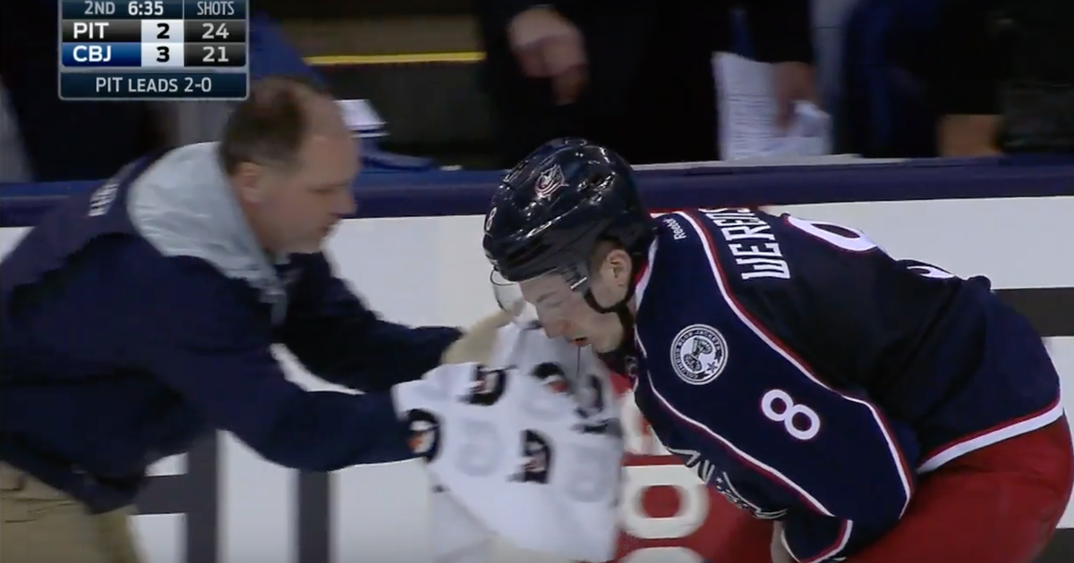 Columbus' Zach Werenski gets hit in the face with puck ...