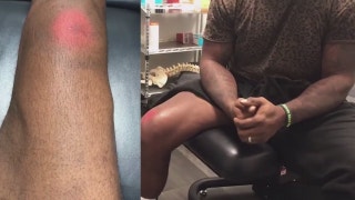 Spencer Ware's recovery continues | PROcast