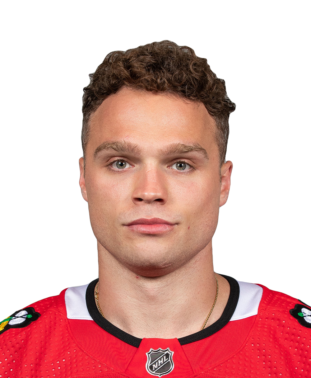 Max Domi shaved his beard for charity : r/hockey