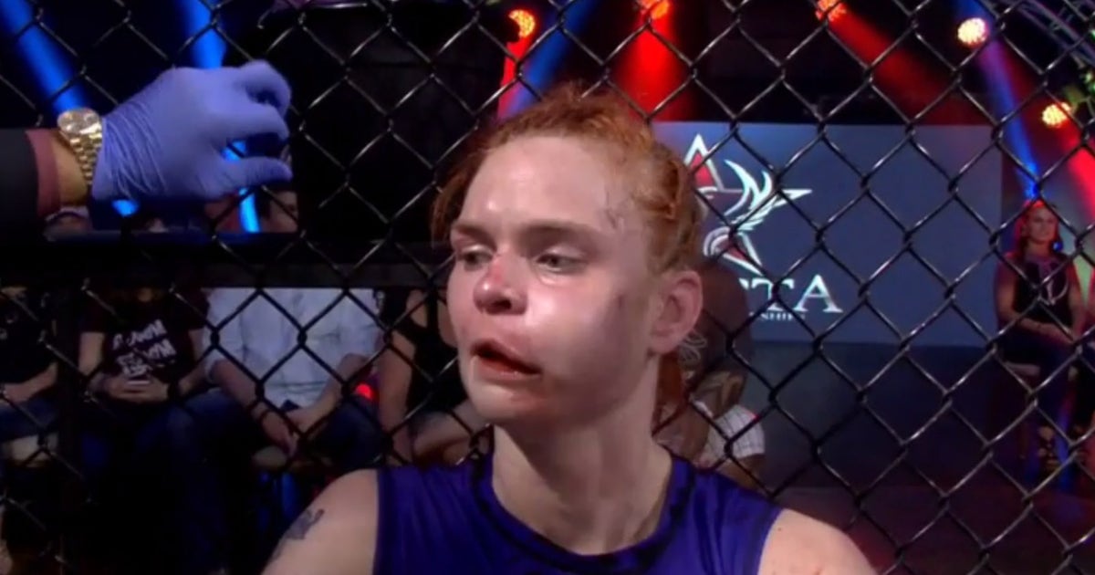 MMA fighter jokes about her gruesome swollen cheek | FOX ...