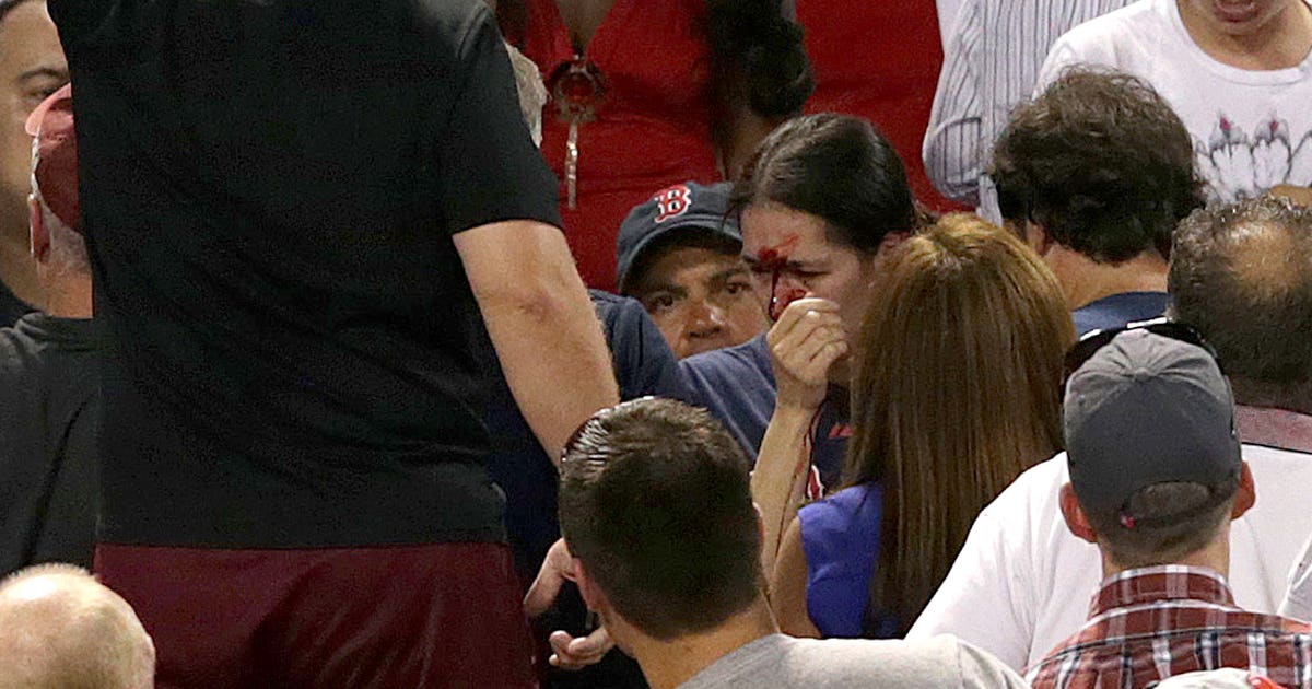 Father of young girl hit by 105-mph foul ball at Yankee Stadium: 'She's  doing all right' : r/baseball