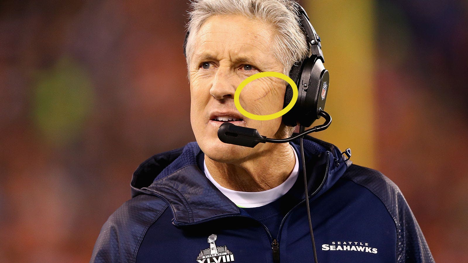 Pete Carroll Gave Awesome Explanation For Mysterious Scratch On